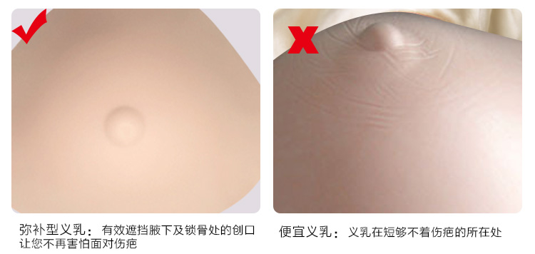 2016小寒蒂億曼义乳厂家术后轻质义乳直销供应加盟