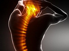 山东{yl}的脊柱疼痛推荐|青岛脊柱疼痛