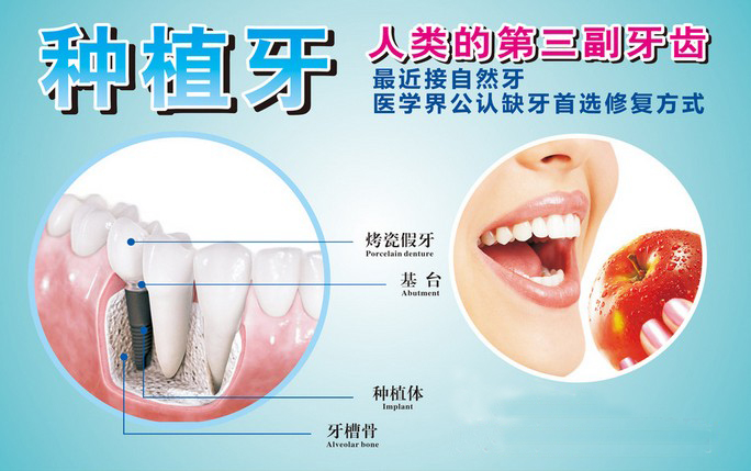 北京市周到的种植牙_北京种植牙修复多少钱