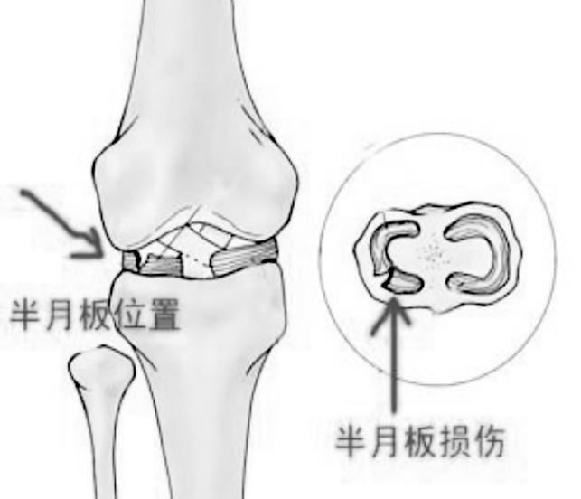 中医治疗腱鞘炎——哪里有提供超值的腱鞘炎治疗