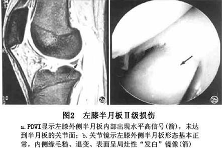 中医治疗膝关节扭伤哪里好？价格怎么样？