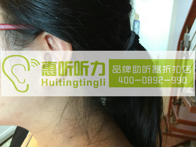 上海徐汇区隐形助听器6折起