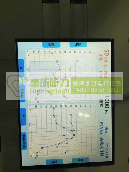 上海松江西门子萨克斯助听器保证全网{zd1}价