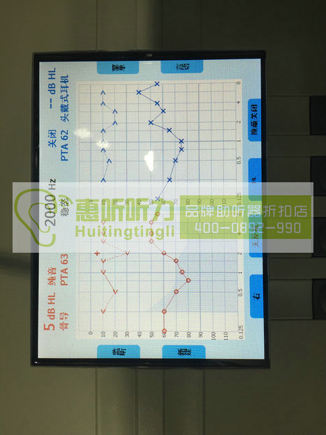 静安区助听器正规授权代理商